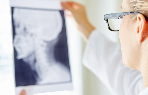Eine Ärztin hält ein Röntgenbild eines Kopfes hoch